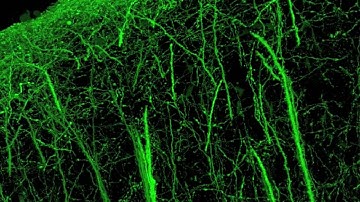 Mouse Cortex Line H YFP Layer 1