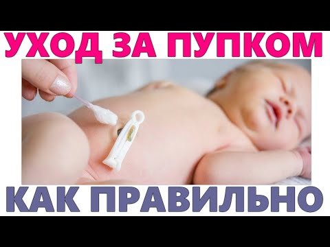 ПУПОК НОВОРОЖДЕННОГО РЕБЕНКА | Уход за пупочной ранкой новорожденного ребенка