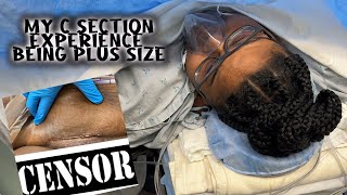 MY C-SECTION EXPERIENCE BEING PLUS SIZE| PRISSY P| LABOR & DELIVERY