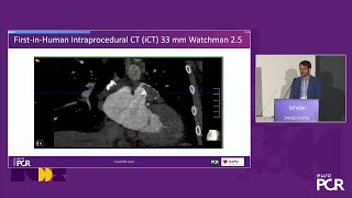 The future of interventional cardiology imaging - EuroPCR 2024
