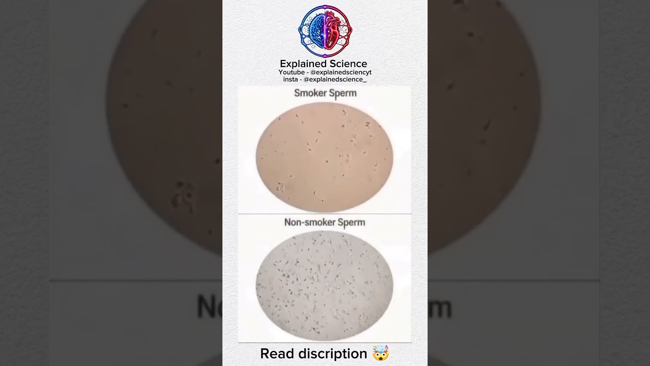 Smoker vs Non-Smoker Sperm Under Microscope 🤯🧬 #shorts #science #health