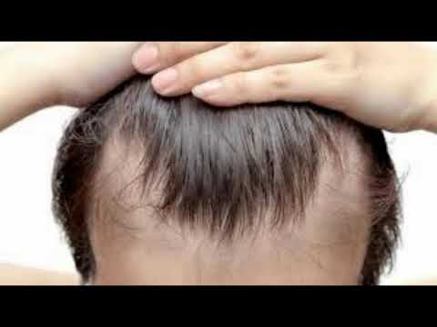 Video: Rënia E Flokëve Të Qenve - Diagnostifikimi I Humbjes Së Flokëve Tek Qentë