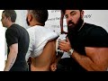 SEVERE *HYPERKYPHOSIS* Y Strap Chiropractic Adjustments and Scraping