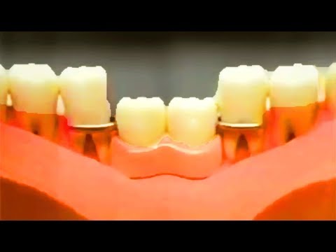 [Nostalgic Commercial] Polident GSK 1999⑥