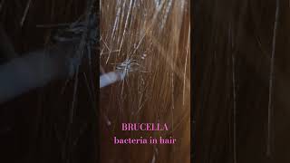 blu ray bacteria parasitic knot@EntoExplorer @GalacticAstrology @ProfessorDaveExplains