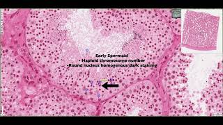 Histology of the Seminiferous Tubules & Interstitium 4K