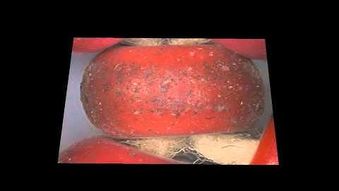 Extended Depth of Field Microscopy--African Bead