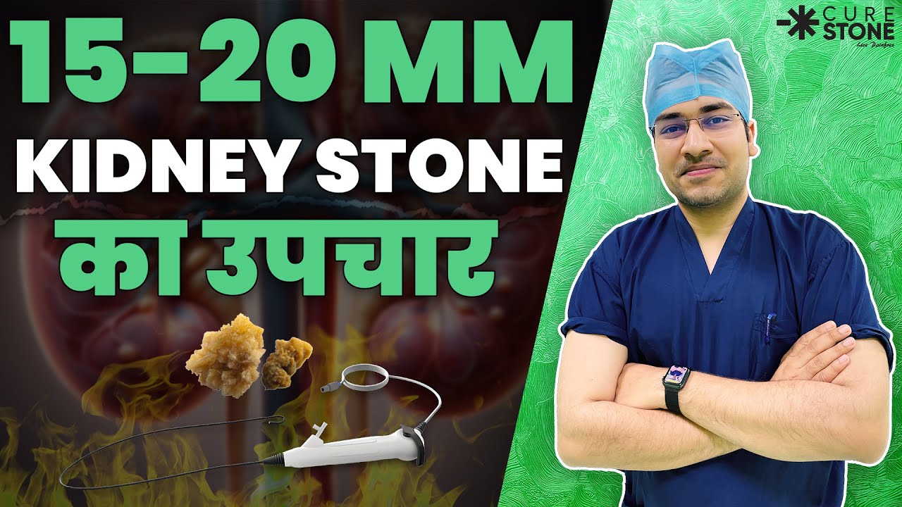 15-20mm-kidney-15-20mm-kidney-stone-treatment