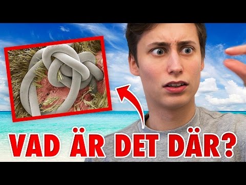 Video: Vad Betyder Mol På Kroppen?