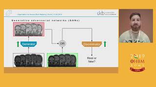 OHBM 2019 | Oral Sessions | Conditional Generative Adversarial Networks Support the Detection …