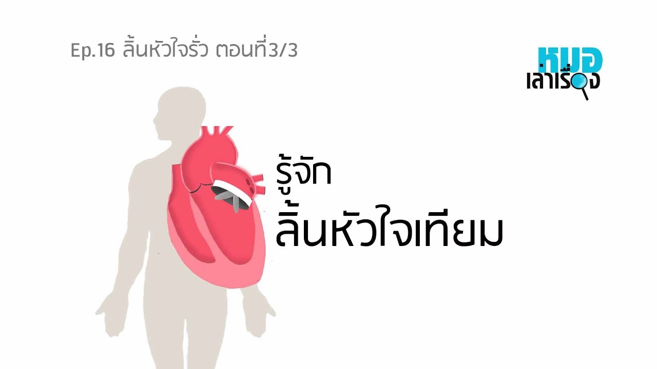 Ep16  ลิ้นหัวใจรั่ว ตอนที่3/3: รู้จัก ลิ้นหัวใจเทียม