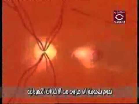 ما هو عصب العين البصري