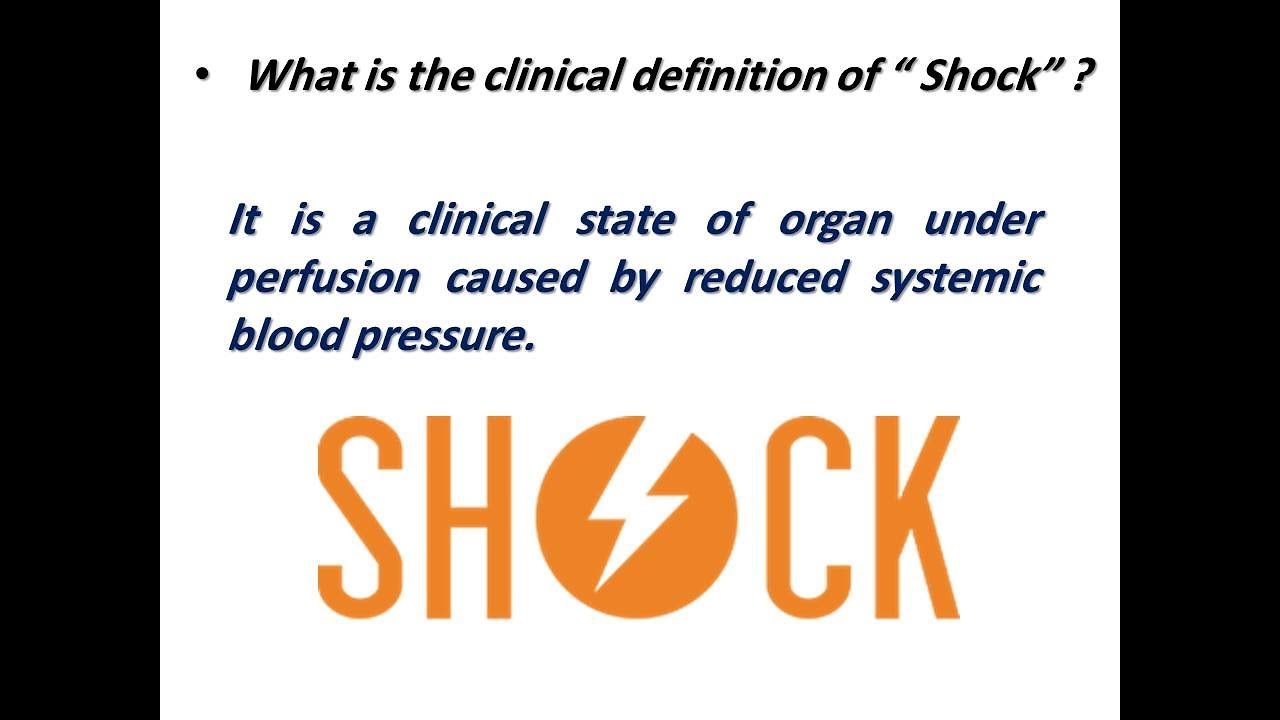 How to deal with a shocked patient (Dr. Sherif Altoukhy)