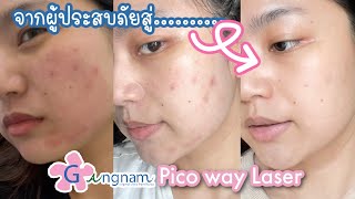 How to ดูแลผิวหน้าหลังทำ Pico laser ft. Gangnam Clinic