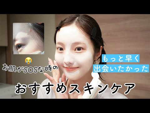 お肌がSOSな時の激推しスキンケア紹介する〜🌤️