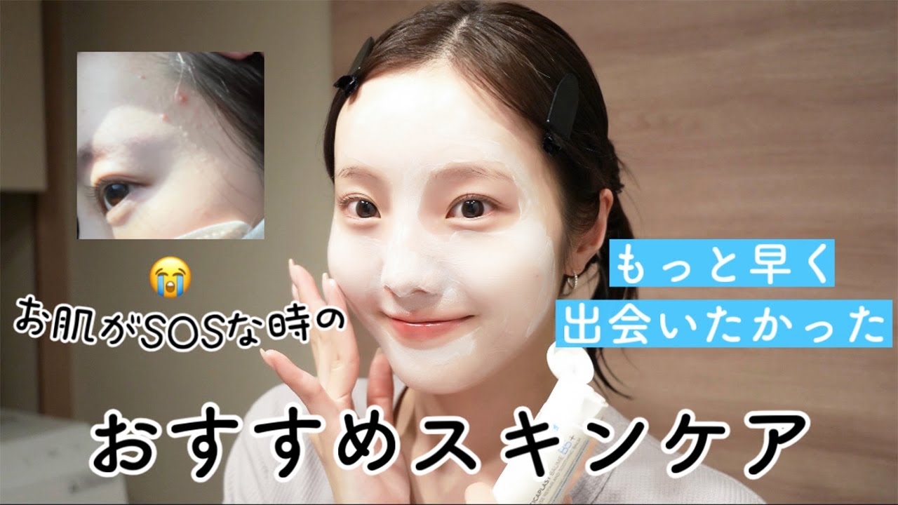お肌がSOSな時の激推しスキンケア紹介する〜🌤️