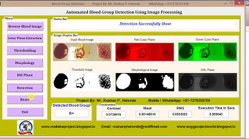 Matlab code for Blood Group type Determination using image processing