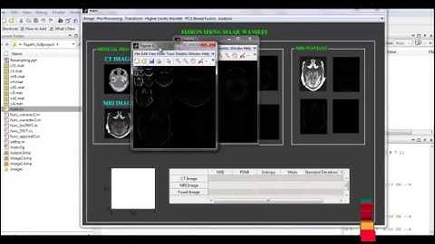 Final Year Projects | Analysis of CT and MRI Image Fusion using Wavelet Transform