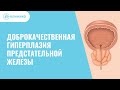 Доброкачественная гиперплазия предстательной железы