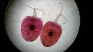 Marine Trematodefluke Cercariae