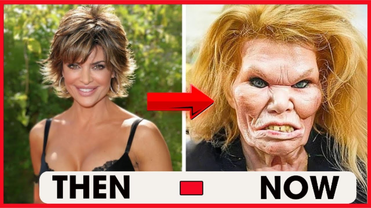10 Hollywood Stars Who Destroyed Their Looks With Plastic Surgery Regrets | Then And Now 2025