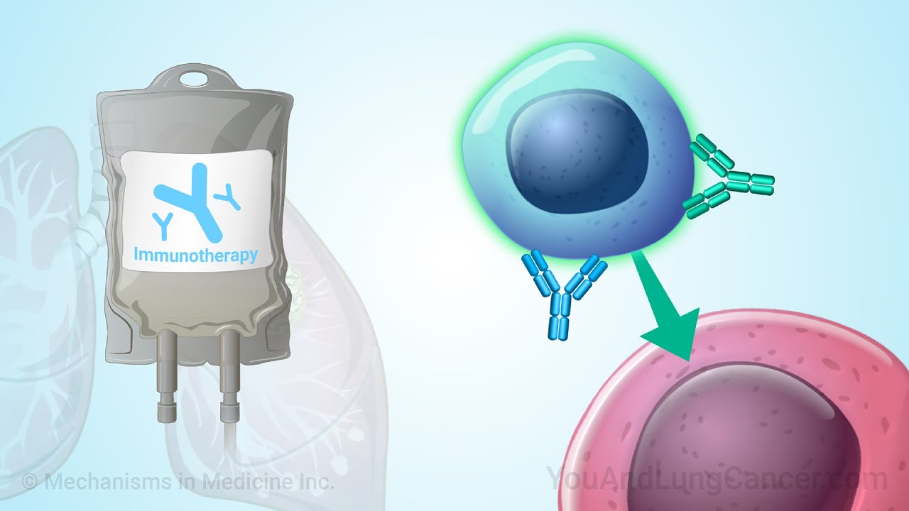 Understanding Immunotherapy for Lung Cancer - updated 2025 - YouTube
