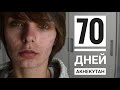 70 дней с АКНЕкутаном(роаккутан)Лечение ПРЫЩЕЙ. Упало зрение.