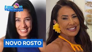 Nova Gretchen? Público Aponta Mudança No Rosto De Scheila Carvalho