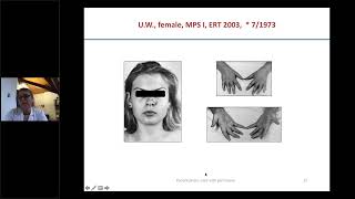 SES S3 M1 Joint and Bone Manifestations of Mucopolysaccharidoses   Case Studies