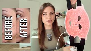 RED LIGHT LED masker REVIEW: werkt dit echt of is het een hype? | Kristina K ❤
