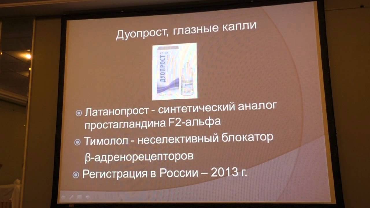 Glaucoma. Kozlova I.V., report AROF-2014, Russia.