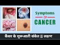          cancer symptoms   rjsk medical