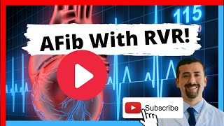 AFib with RVR: Symptoms and Treatment by Doctor AFib 18,451 views 1 year ago 12 minutes, 24 seconds