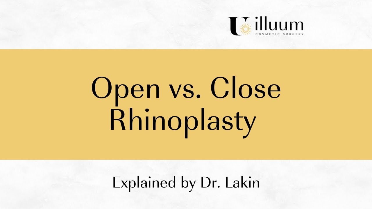 Open or Close Rhinoplasty | Explained by Dr. Lakin