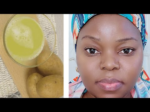 Vidéo: 15 Meilleurs Packs De Visage De Pomme De Terre Pour Une Peau éclatante, Claire Et Lisse