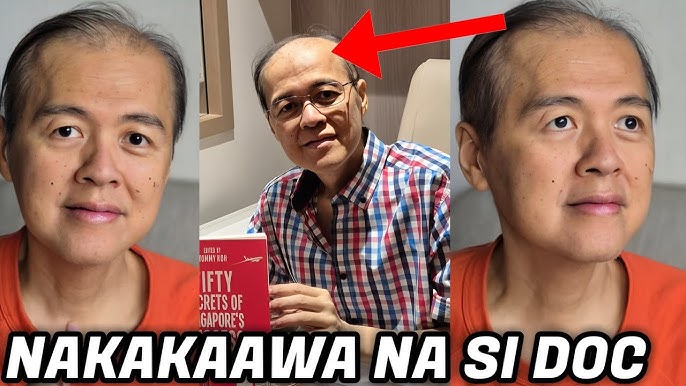 Doc Willie Ong IBINAHAGI ang TUNAY na KALAGAYAN NGAYON NALAGAS na ang BUHOK  ni Doc NAKAKAAWA NA!