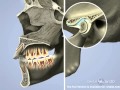 Airway and TMJ English
