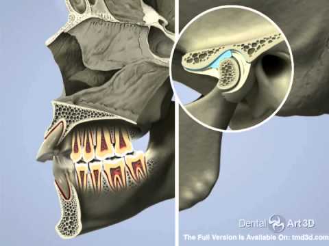 Whether TMD or trismus, jaw trouble needs attention