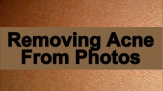 How to remove acne from your pictures screenshot 3