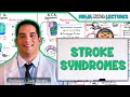 Gambar cover Stroke Syndromes: MCA, ACA, ICA, PCA, Vertebrobasilar Artery Strokes | Pathophysiology
