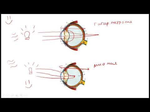 Офтальмология | Рефракция глаза