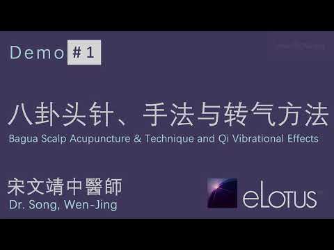 Bagua Scalp Acupuncture & Technique and Qi Vibrational Effects | 八卦头针、手法与转气方法 by 宋文靖中醫師 Dr. WJ Song