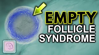 Ivf Empty Follicle Syndrome