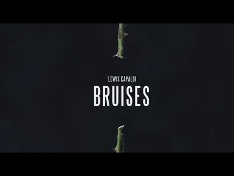 Lewis Capaldi Bruises Official Audio