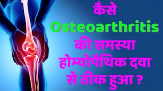 कस Osteoarthritis क समसय हमयपथक दव स ठक हआ Homeopathic Treatment For Osteoarthritis