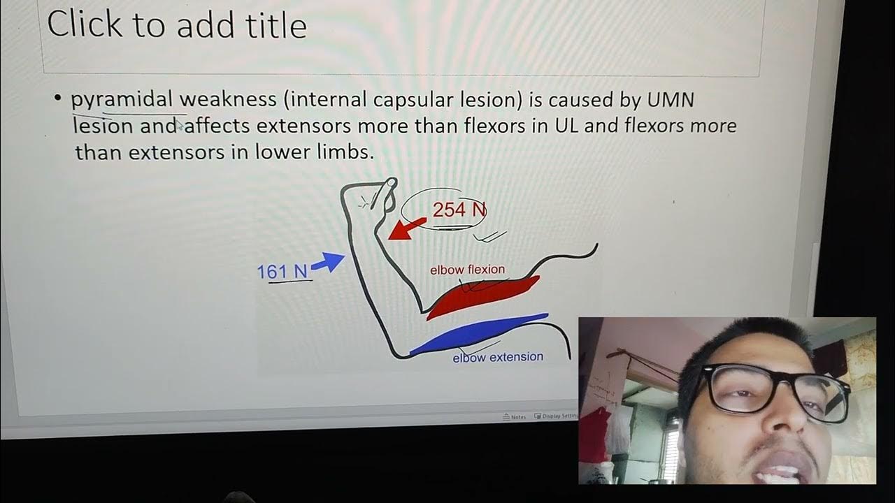 pyramidal weakness YouTube