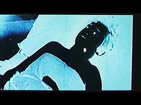 Tracheotomy - "OBDURATE ENMITY" - Official Video