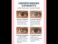 "Understanding Cataract"#visioncare #eyedisease #eyes #science #eyehealth #optometry #ophthalmology