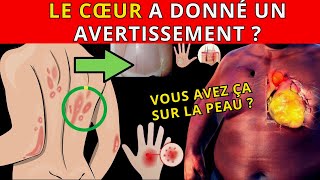 12 SIGNES SUR LA PEAU et les ONGLES qui ALERTENT sur un PROBLÈME de CŒUR CACHÉ