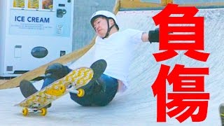 【悲報】マスオ久々にガチめの怪我をする。